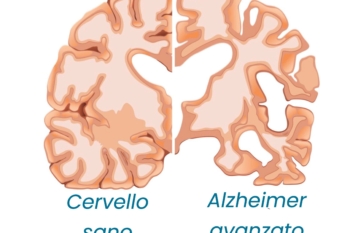 Giornata mondiale dell’Alzheimer: la diagnosi precoce può fare la differenza